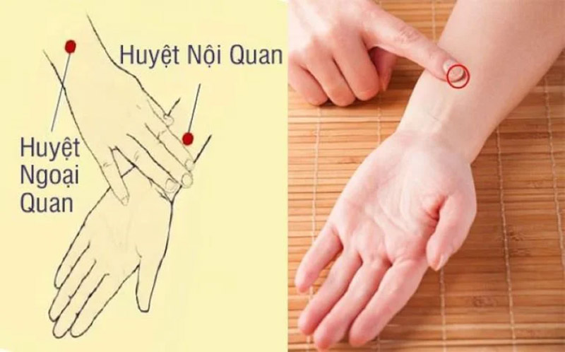Vị trí huyệt Nội Quan