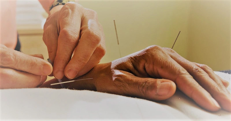 Các bước châm cứu huyệt Bát Tà được thực hiện bởi chuyên gia