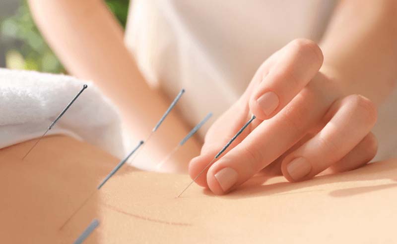 Châm cứu huyệt Mệnh Môn thật cẩn trọng với từng thao tác