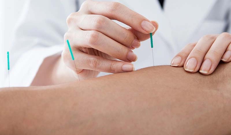 Châm cứu huyệt Xích Trạch tại cơ sở y tế uy tín