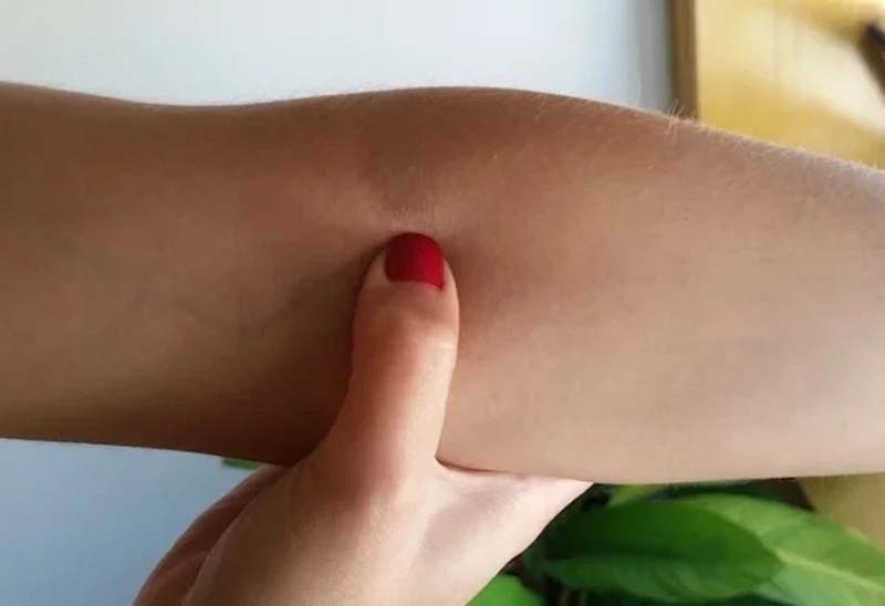 Bấm huyệt Xích Trạch tại nhà với các thao tác đơn giản