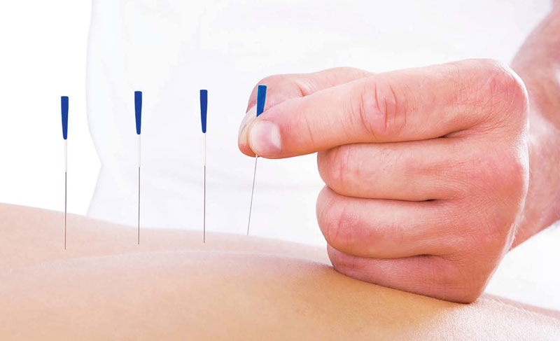 Châm cứu huyệt Hoành Cốt