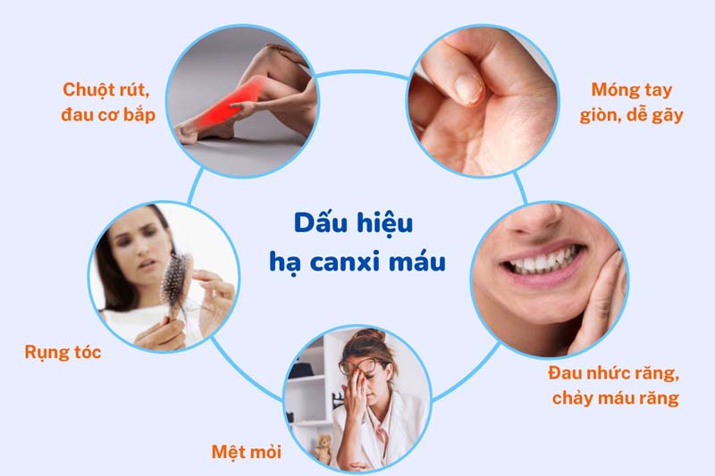 Chuột rút là một trong những biểu hiện của thiếu hụt canxi