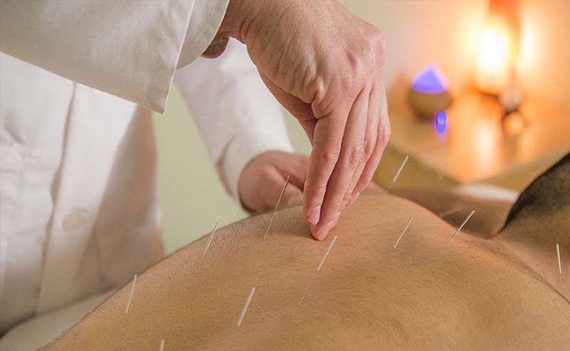 Châm cứu huyệt Can Du được thực hiện bởi các chuyên gia