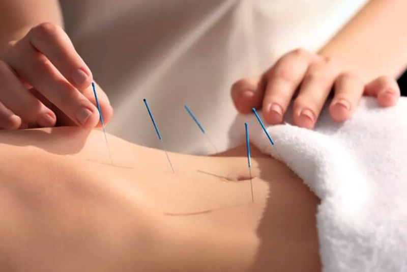 Châm cứu huyệt Thiên Khu kích thích khí huyết vùng bụng