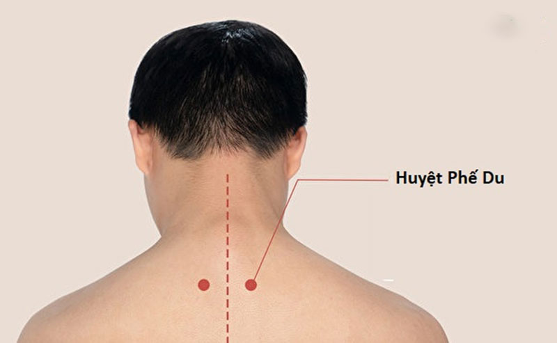 Huyệt Phế Du nằm sau gáy