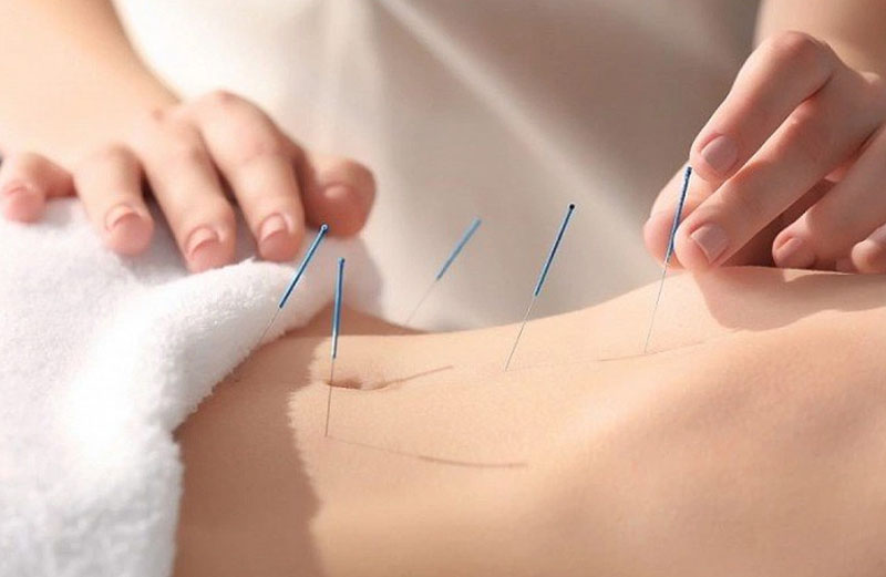 Châm cứu huyệt Phúc Kết điều trị các bệnh lý mãn tính