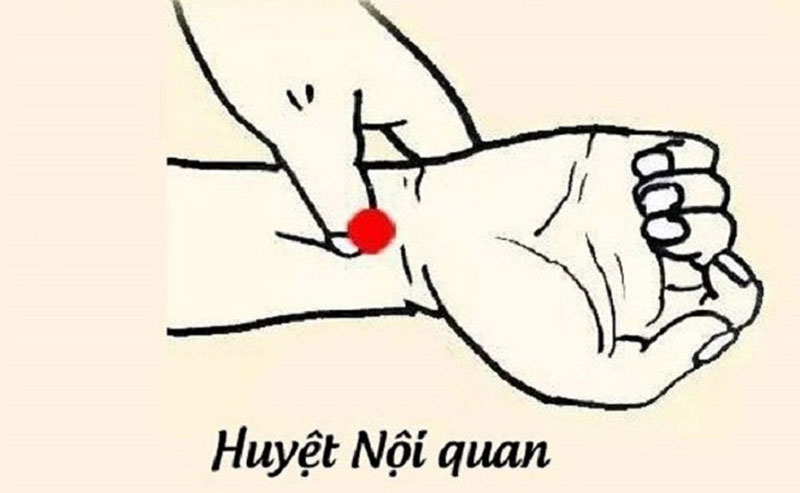 Vị trí huyệt Nội Quan