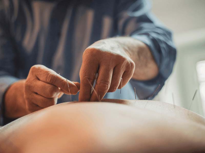 Châm cứu là phương pháp hiệu quả để điều trị tình trạng đau lưng mãn tính