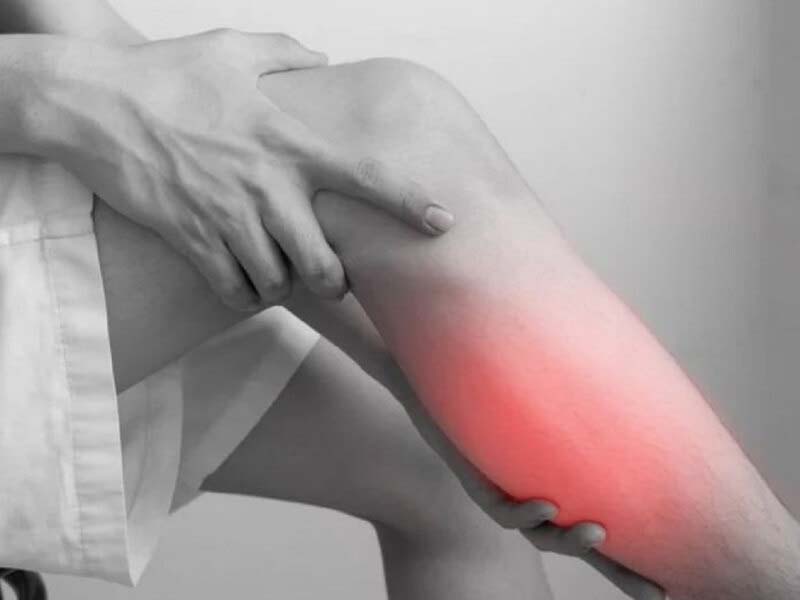 Căng cơ bắp chân gây đau nhức, sưng, bầm tím, hạn chế vận động
