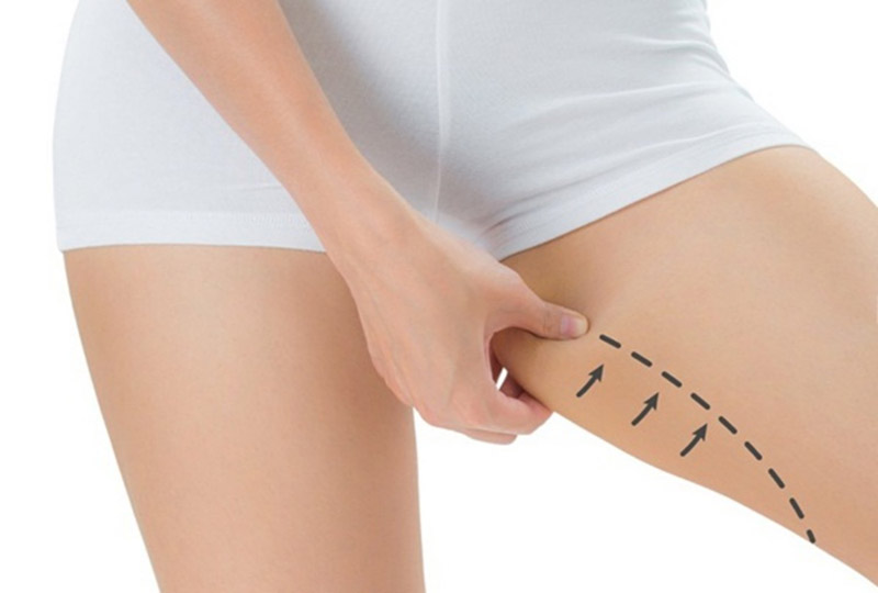 Giảm mỡ đùi bằng bấm huyệt