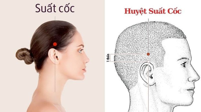 Các huyệt trên đầu