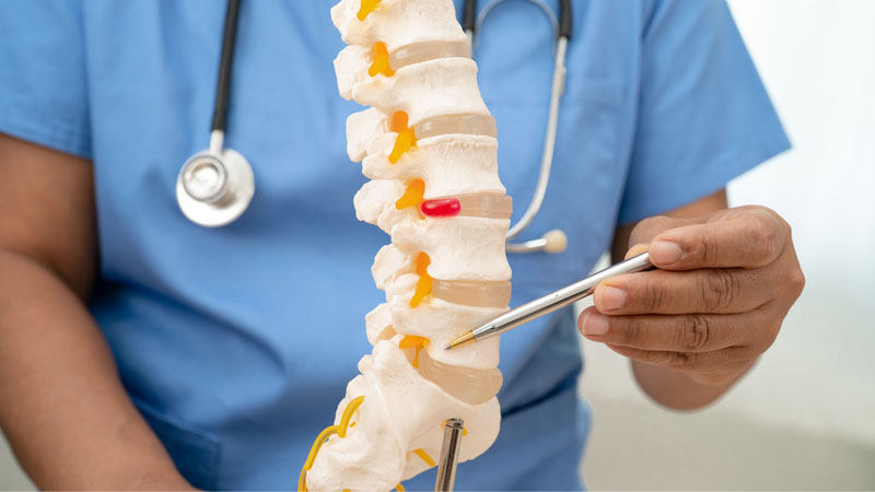 Thoát vị đĩa đệm cột sống cổ là bệnh lý để lại nhiều biến chứng nguy hiểm