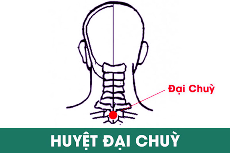 Huyệt Đại Chùy - huyệt vai cổ gáy nằm ở vị trí đặc biệt