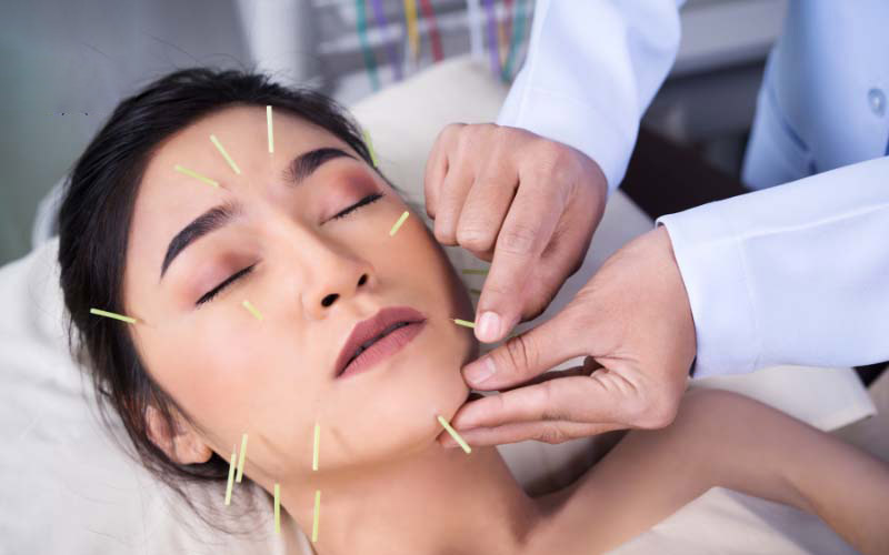 Châm cứu huyệt Địa Thương cần thật cẩn trọng để tránh gây nguy hiểm