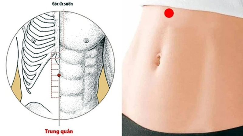 Vị trí huyệt vùng bụng Trung Quản