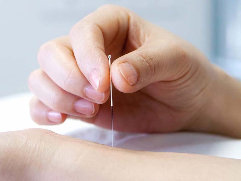 Châm cứu huyệt Đại Lăng đảm bảo tuân thủ các nguyên tắc và lưu ý