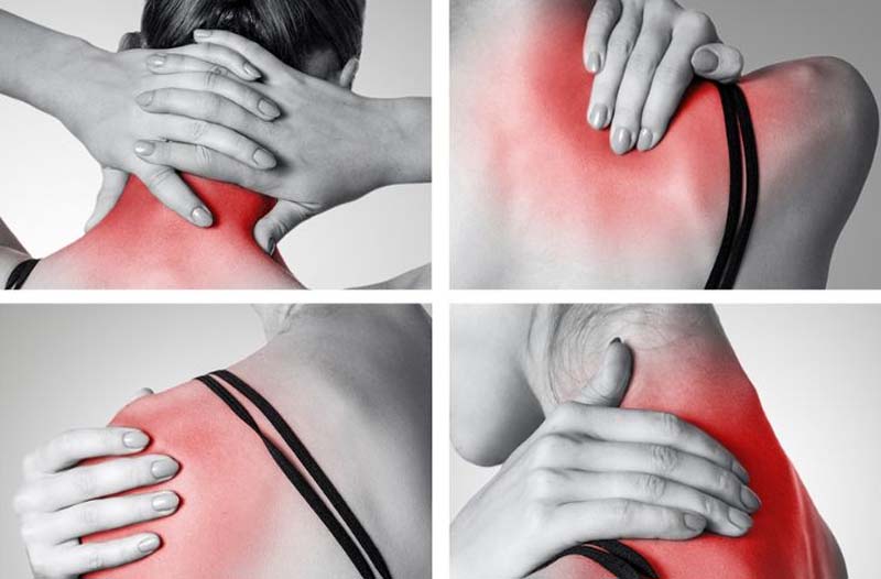 Cơ vai bị căng cứng chính là tình trạng bó cơ vai