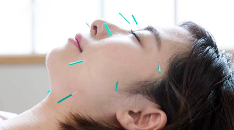 Châm cứu huyệt Hạ Quan với kỹ thuật cao