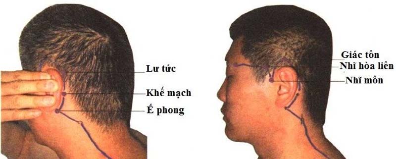 Vị trí huyệt Ế Phong nằm ngay sau tai
