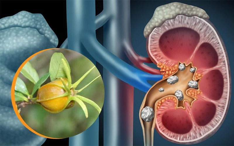 Huyệt Kinh Môn hỗ trợ điều trị viêm thận