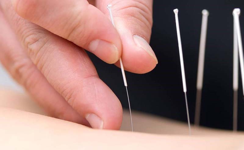 Châm cứu huyệt Đản Trung tại cơ sở y tế uy tín