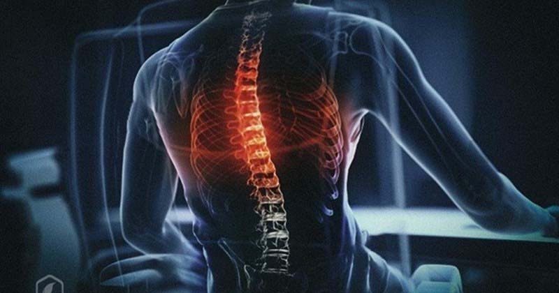Bệnh lý xương khớp là nguyên nhân thường gặp gây ra đau lưng giữa ở cả nam và nữ