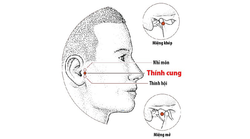 Vị trí huyệt Thính Cung