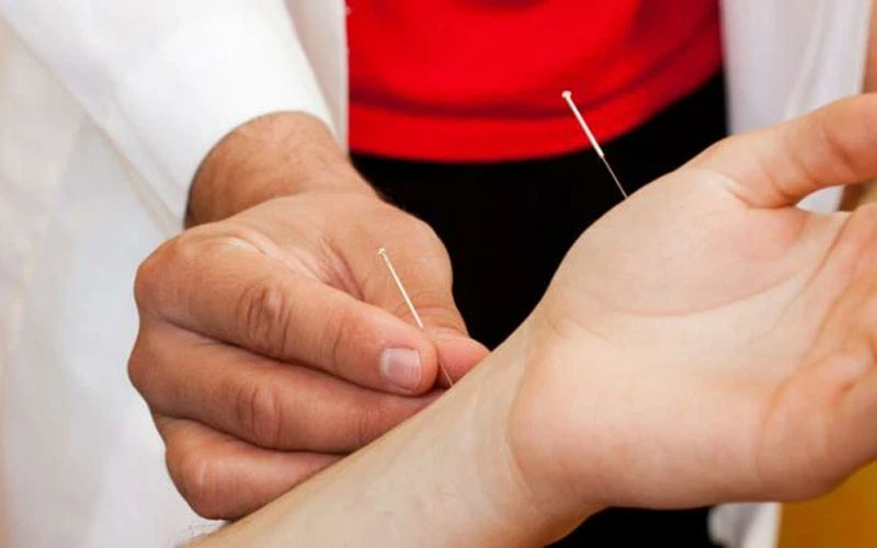 Cách châm cứu huyệt Âm Khích