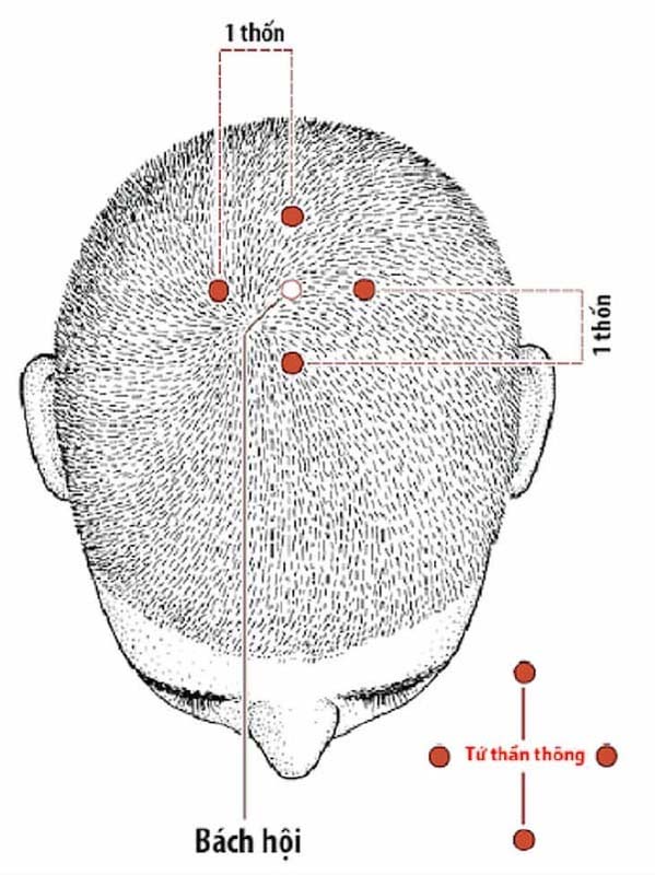 Vị trí huyệt Tứ Thần Thông nằm bao xung quanh huyệt Bách Hội