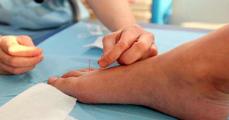 Châm cứu huyệt Thái Xung mang lại hiệu quả chuyên sâu