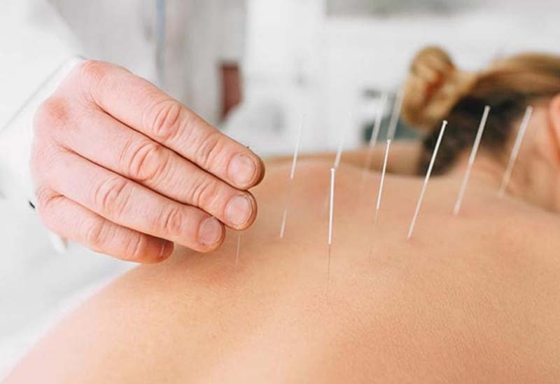 Châm cứu huyệt Giáp Tích tại cơ sở y tế uy tín