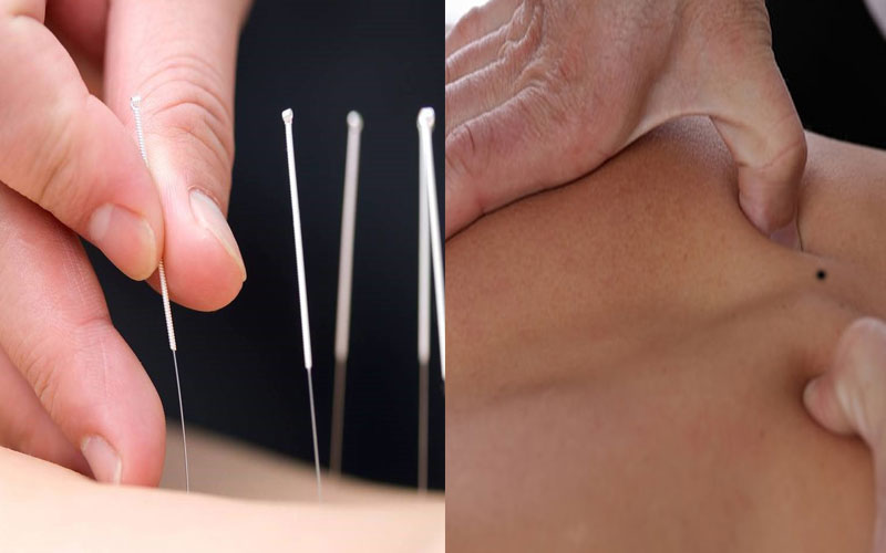 Châm cứu bấm huyệt là gì? Tác dụng và cách phân biệt