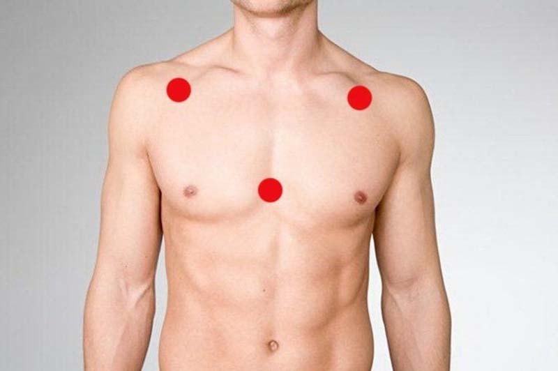 Huyệt Trung Phủ: Vị trí, tác dụng và cách châm cứu, bấm huyệt