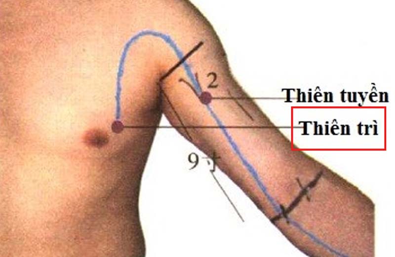 Huyệt Thiên Trì: Vị trí, tác dụng và cách châm cứu, bấm huyệt