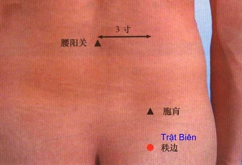 Huyệt Trật Biên: Vị trí, tác dụng và cách châm cứu, bấm huyệt